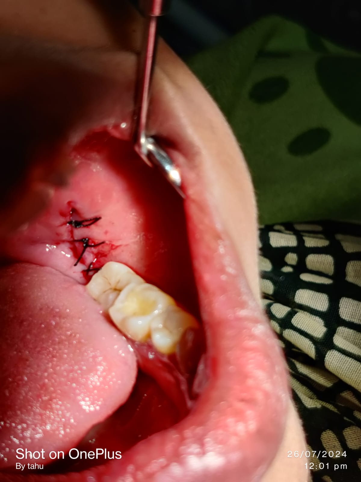 Dental Health Care Gallery 1
